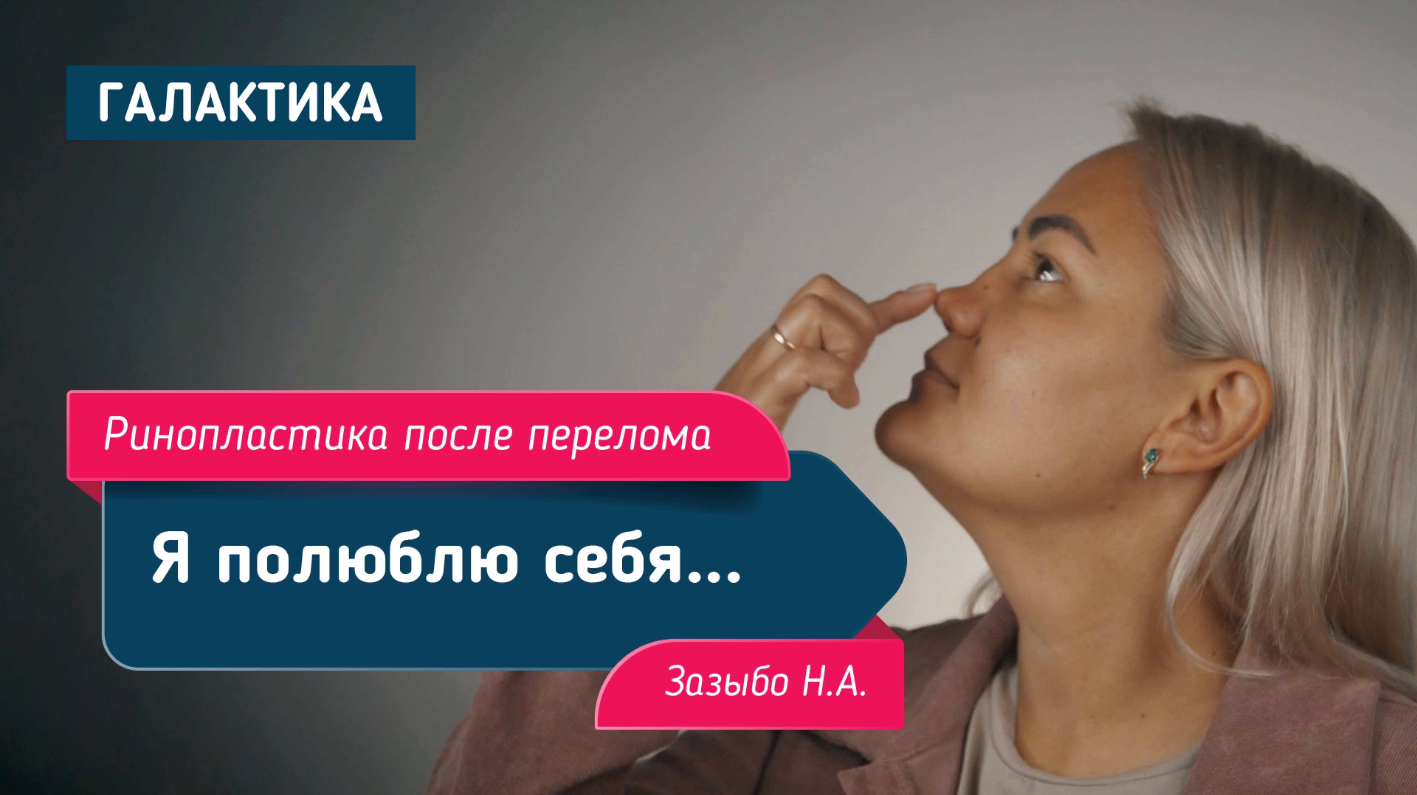 Ринопластика после перелома | Зазыбо Николай Александрович
