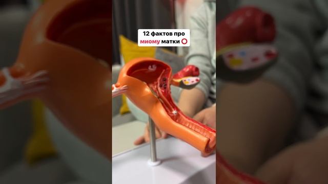 Факты о миоме, которые помогут начать исцеление📌