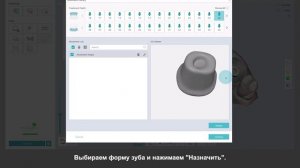 Определение абатментов на внутриротовых сканах устройств Medit | DTX Studio Clinic