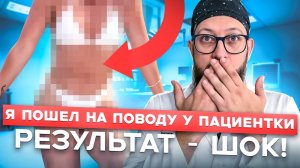 Пациентка отказывалась от абдоминопластики: что из этого вышло?