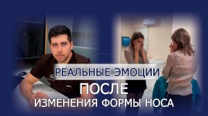 Искусство пластики носа: коррекция формы и восстановление дыхания