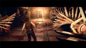 ▼Zvo Wnootree [The Evil Within]