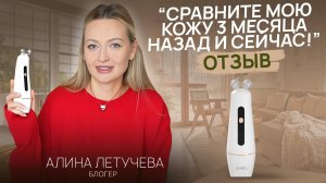 Честный отзыв о массажере VIA. Подтяжка и омоложение лица с помощью микротоков и рф лифтинга