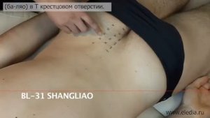 Эндометрит