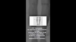 12 акупунктурных точек для седалищного нерва