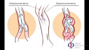 УЗИ вен на ногах Флебология Москва