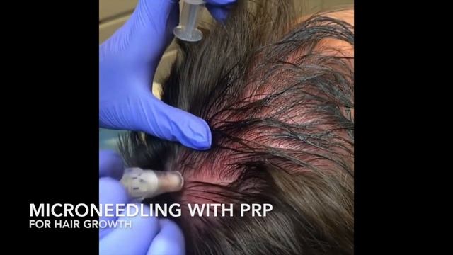 Rejuve Medica - Medical Spa & Aesthetics in Edgewater NJ смотреть онлайн