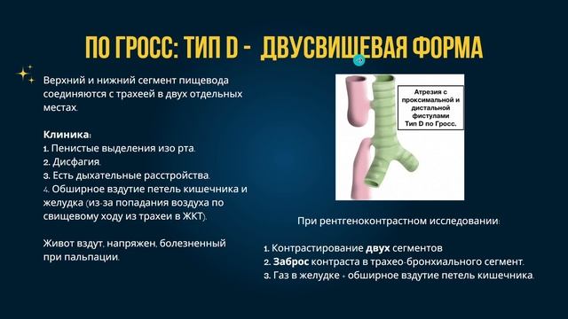 Атрезия пищевода и трахеопищеводный свищ у детей | Ответ на все вопросы | Лекции по детской хирургии