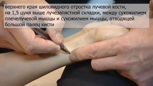 Ячмень