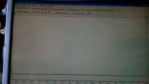 Провалы при нажатие на педаль газа на инжекторе