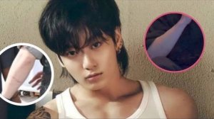 Чонгук выражает обеспокоенность по поводу своей травмированной руки, что случилось