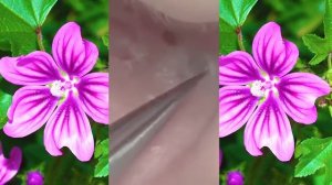 удаление прыщей уха уход за кожей