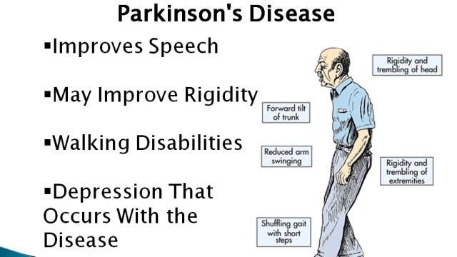 What Is Phenylalanine? Nutritional supplement Phenylalanine смотреть онлайн