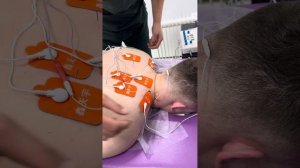 Иглотерапия с внутритканевой электростимуляцией часть 3