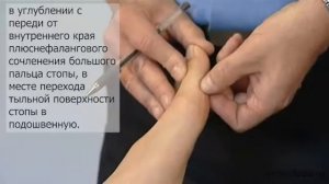 Гиперменорея