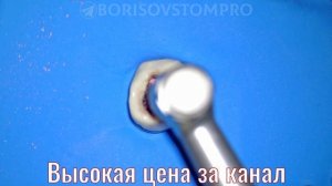 Как выбрать файлы для перелечивания каналов? R-Shaper Protaper Retreatment Geosoft Reatreat File