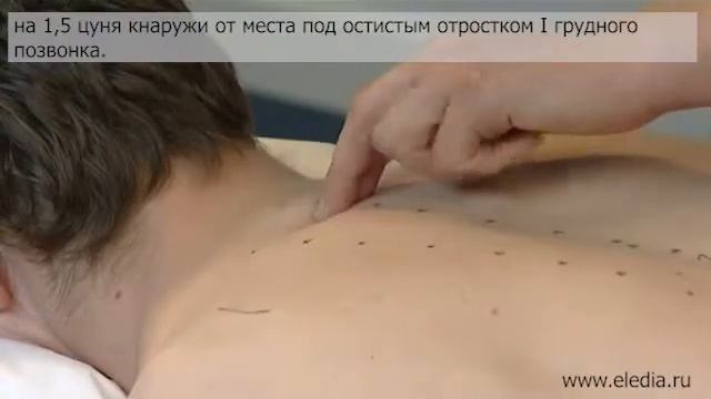 Миозит, миалгия