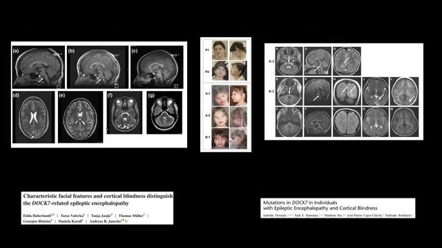 Paediatric neuroscience case discussion session : Jan 28, 2022 смотреть онлайн