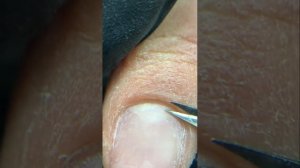 Как сделать срез кутикулы ножничками