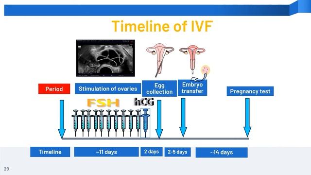 IVF counselling 1 - In Vitro Fertilization IVF： Overview смотреть онлайн
