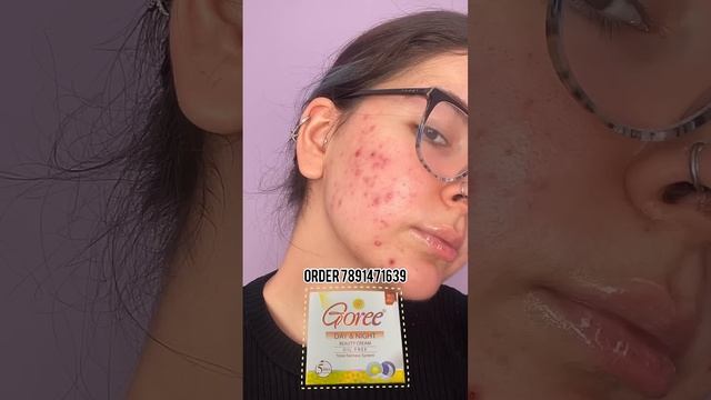 100% Goree day night cream skin whitening cream 5 days challenge pigmentation treatment #shortvideo
