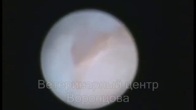 остеохондрит таранной кости смотреть онлайн