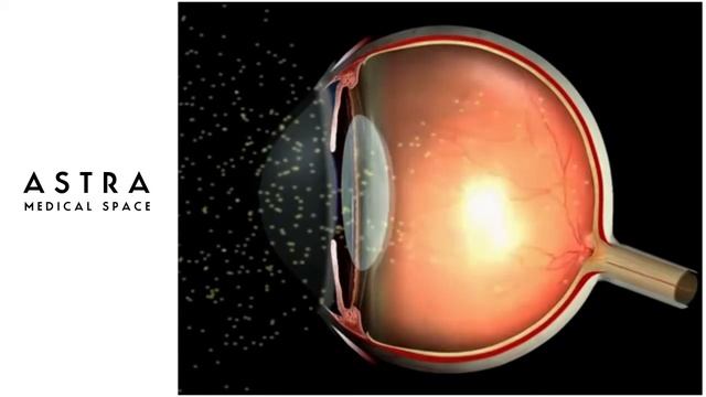 Фізіологія зорового аналізатора (анімаційне-відео) смотреть онлайн