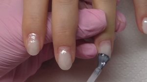 ХРОНИКА что стало с больным ногтем? Зря покрыли, стало хуже?