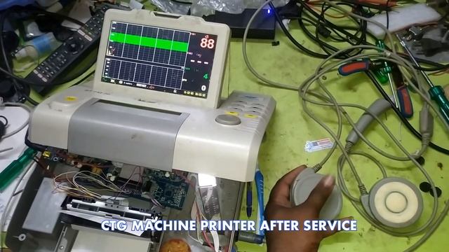 #13 WELCARE CTG MACHINE PRINTER PROBLEM REPAIR - смотреть видео онлайн ...