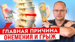 Почему НЕМЕЮТ Конечности! Как Вылечить Грыжу Просто Сделайте ЭТО ...