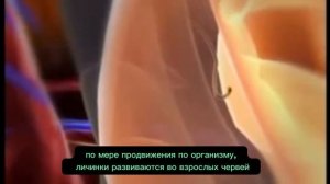 Жизненный цикл гвинейского червя (ришты)