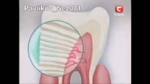 Реклама зубной пасты Sensodyne 2010
