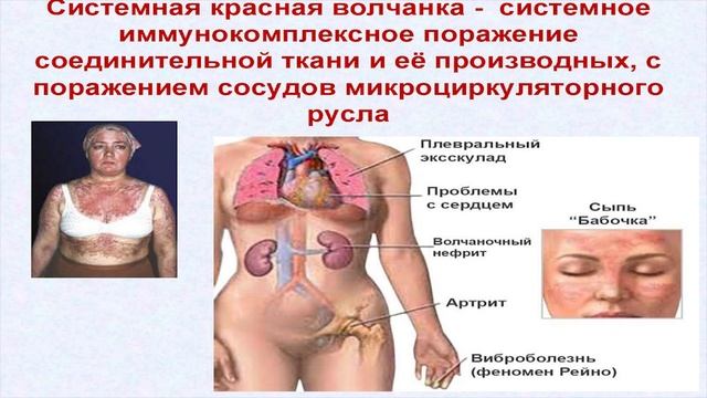 ТОП 5 самых опасных болезней в мире!!