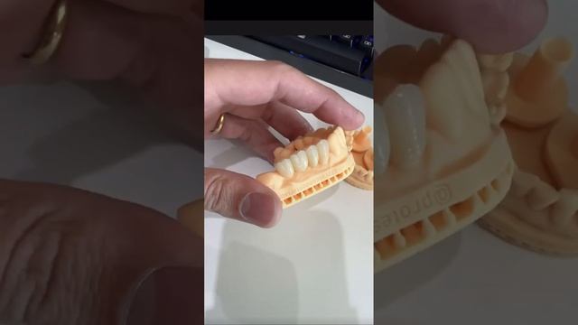 Zirconia multilayer смотреть онлайн