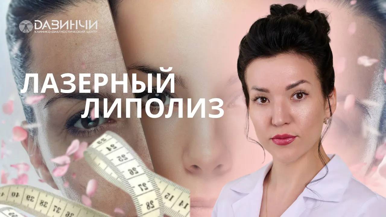 Лазерный липолиз