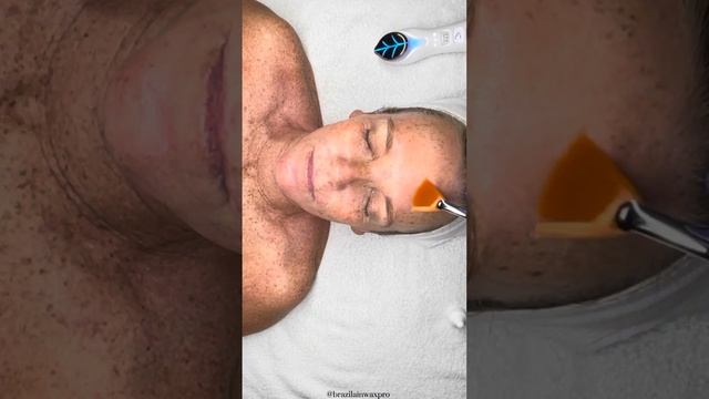 Beautiful Skin Results ASMR iSOV Spider Peel How To #ISOV #facial #skincare #esthetician #asmr #fyp