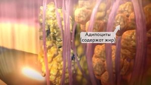 Как убрать второй подбородок? Быстро и без операций. Липолитики.