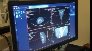 CT scan wrist joint done on Siemens somatom healthineers go.up