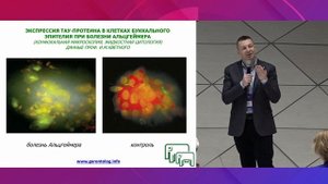 Диагностика деменции. Рассказывает д.м.н., геронтолог Кирилл Иванович Прощаев