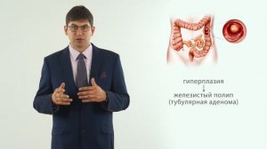 полипы толстой кишки (полип анального канала, полип прямой кишки)