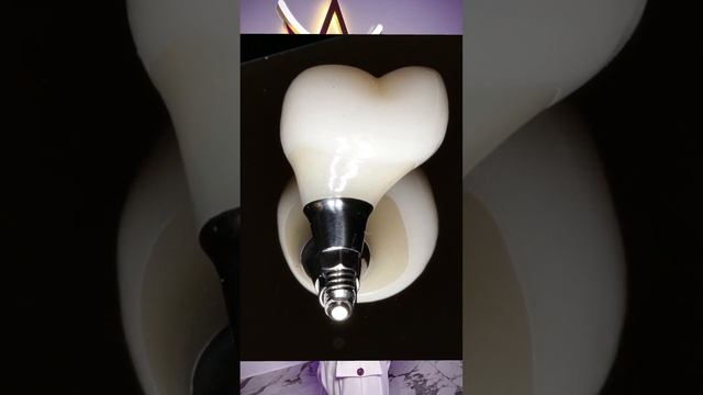 Как должна выглядеть коронка на импланте? #коронканазуб #имплантациязубов