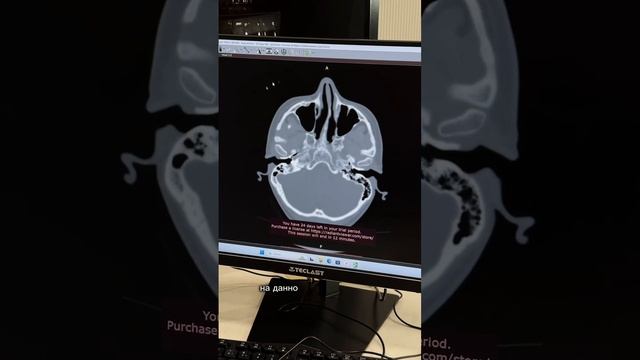 Риносептопластика с доктором Ивановым - нюансы и особенности пластической операции