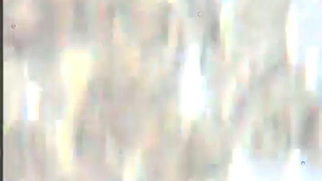 Онкология. Кровь под микроскопом. Гемосканирование. смотреть онлайн