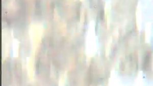 Онкология. Кровь под микроскопом. Гемосканирование.