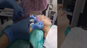 Инъекции препаратом Repart PG #косметология