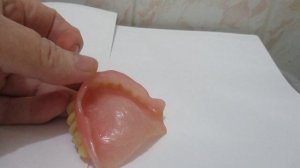 Акриловый зубной протез: детальный осмотр и внешний вид