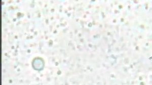 Пастеризованное коровье молоко под микроскопом