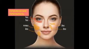 Филлеры Etrebelle | 2filler.ru