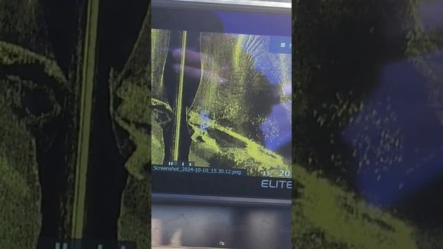 Lowrance elite 9 fs затонувший корабль #Lowrence #лоуренс смотреть онлайн