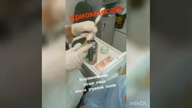 Криомассаж лица